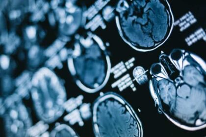 Como o jejum intermitente afeta o seu cérebro?