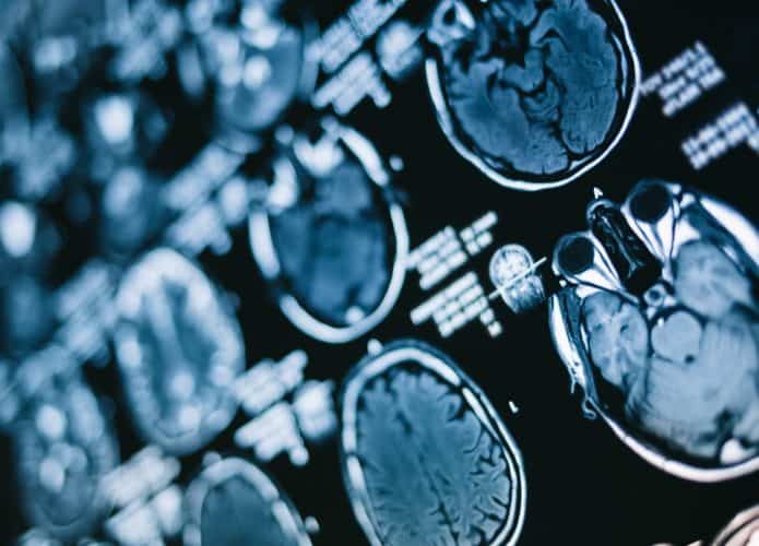 Como o jejum intermitente afeta o seu cérebro?