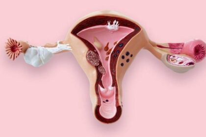 Mil mulheres são diagnosticadas com câncer de colo de útero anualmente na Bahia, informa Ministério da Saúde