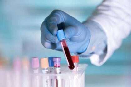 Exame de sangue poderá diagnosticar câncer de intestino