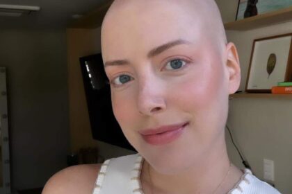 Fabiana Justus reflete sobre perder cabelo durante tratamento contra câncer: "Minha menor preocupação"