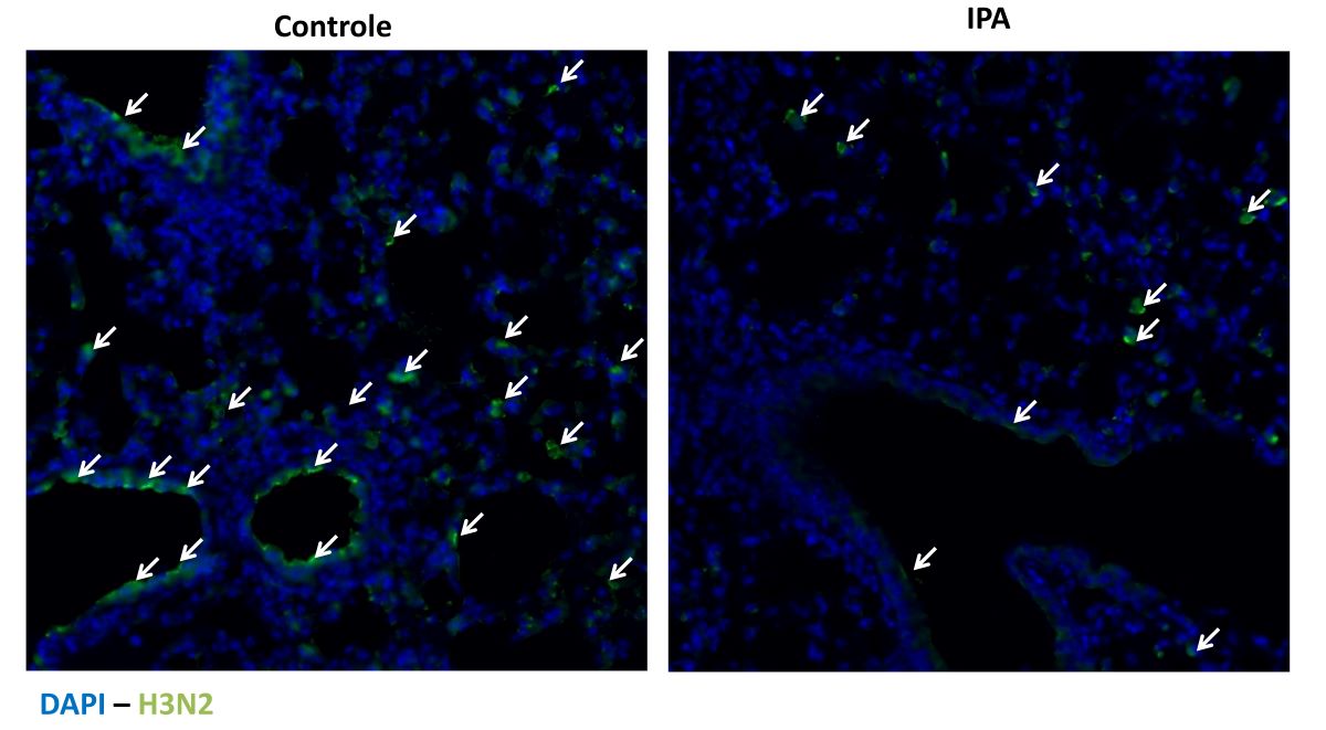 Estudo aponta que molécula produzida no intestino pode proteger contra gripe