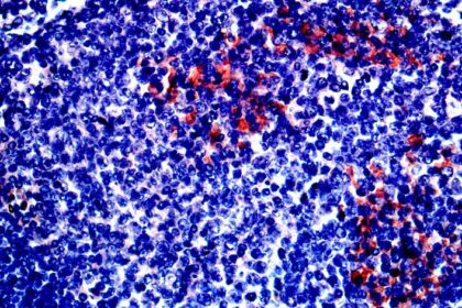 Importância das amígdalas e adenoides na persistência do SARS-CoV-2 em crianças: Um guia completo