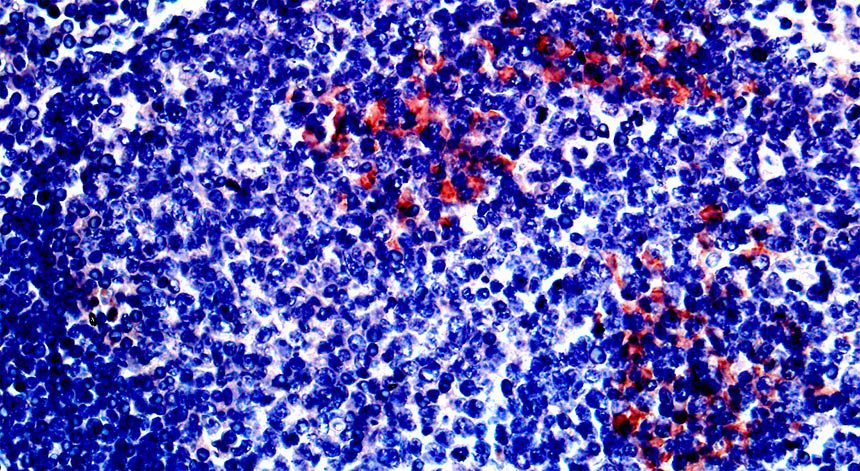 Importância das amígdalas e adenoides na persistência do SARS-CoV-2 em crianças: Um guia completo