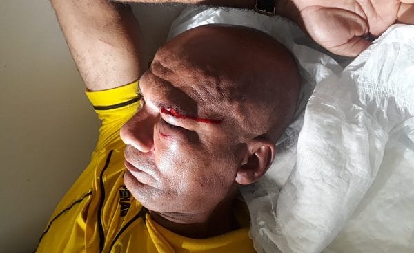 Jogador agride árbitro de futebol em campeonato amador disputado em Ipiaú