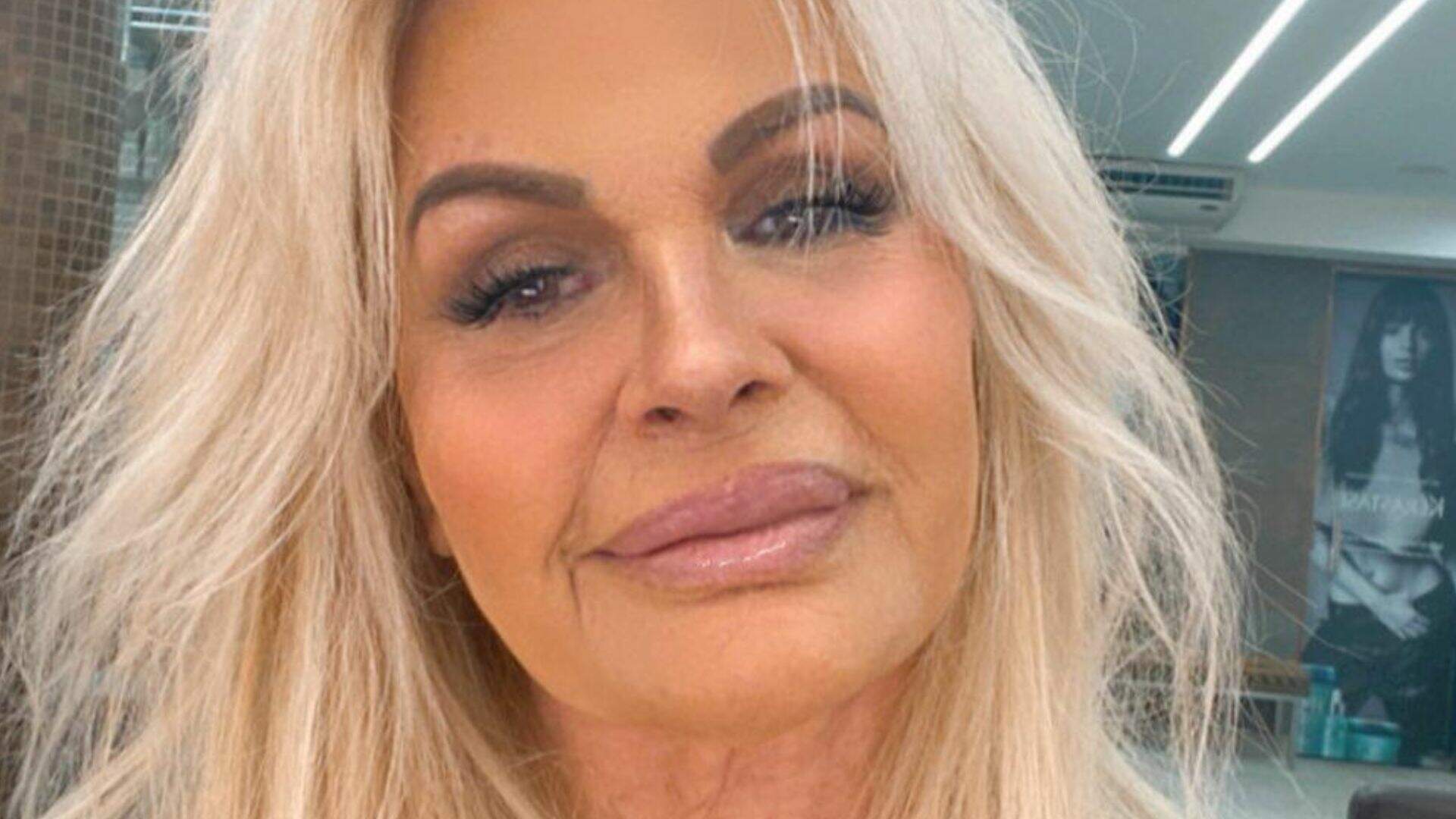 Monique Evans retoca harmonização facial antes do casamento e exibe novo visual