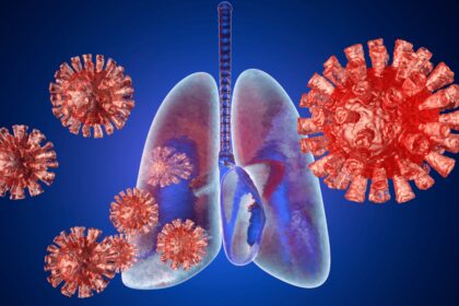 pacientes têm sequelas respiratórias dois anos depois