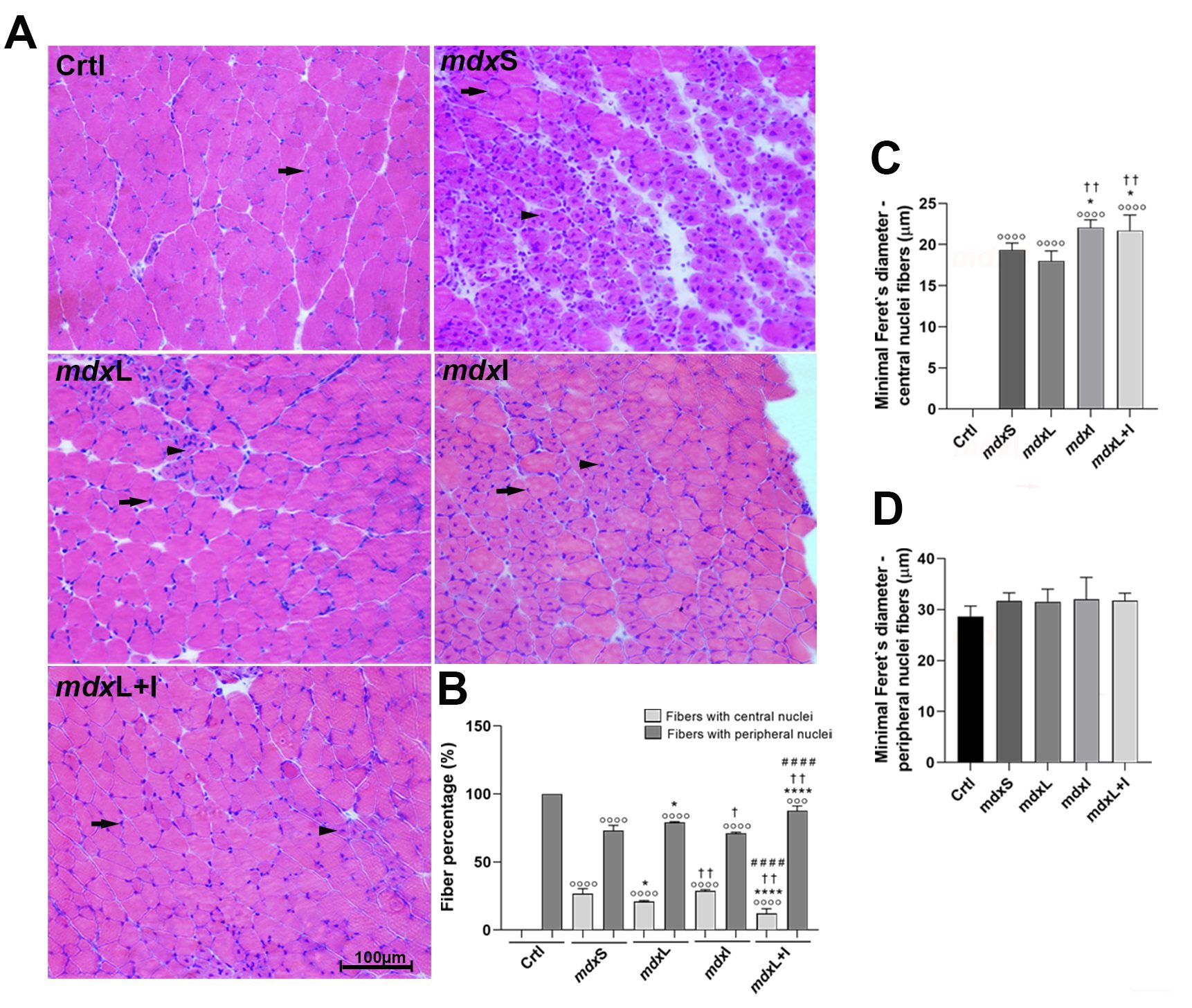 Nova estratégia para minimizar evolução da distrofia muscular de Duchenne: Grupo realizou testes promissores