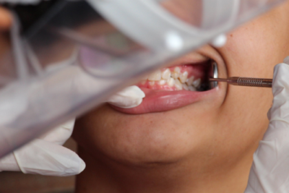 Substância secreta por fungos pode ser eficaz contra biofilme causador de cárie dental