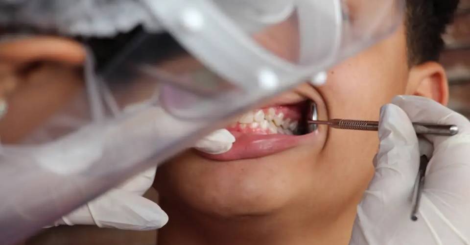 Brasil busca aumentar cobertura de saúde bucal para 70%