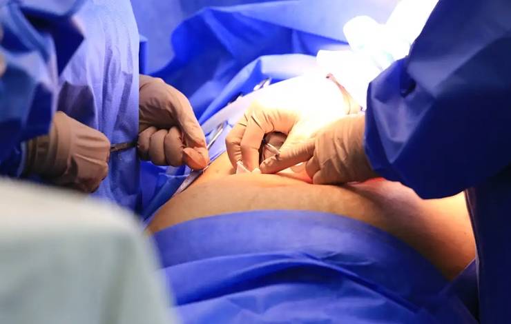 Congresso sobre transplante de órgãos em Salvador começa na quarta-feira (5)