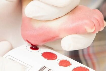 Manifesto por ampliação do teste do pezinho.