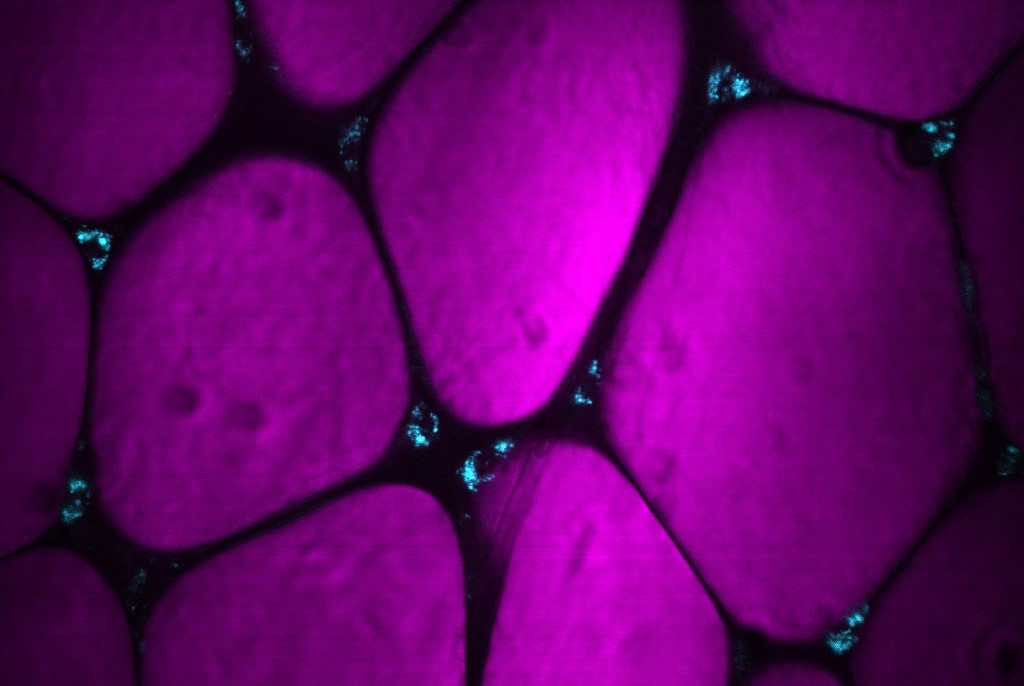 Estudo identifica novo fator de risco para COVID-19 grave em indivíduos obesos