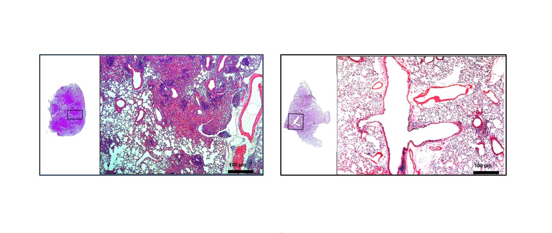 Novos resultados da vacina contra a tuberculose são revelados durante a FAPESP Week China
