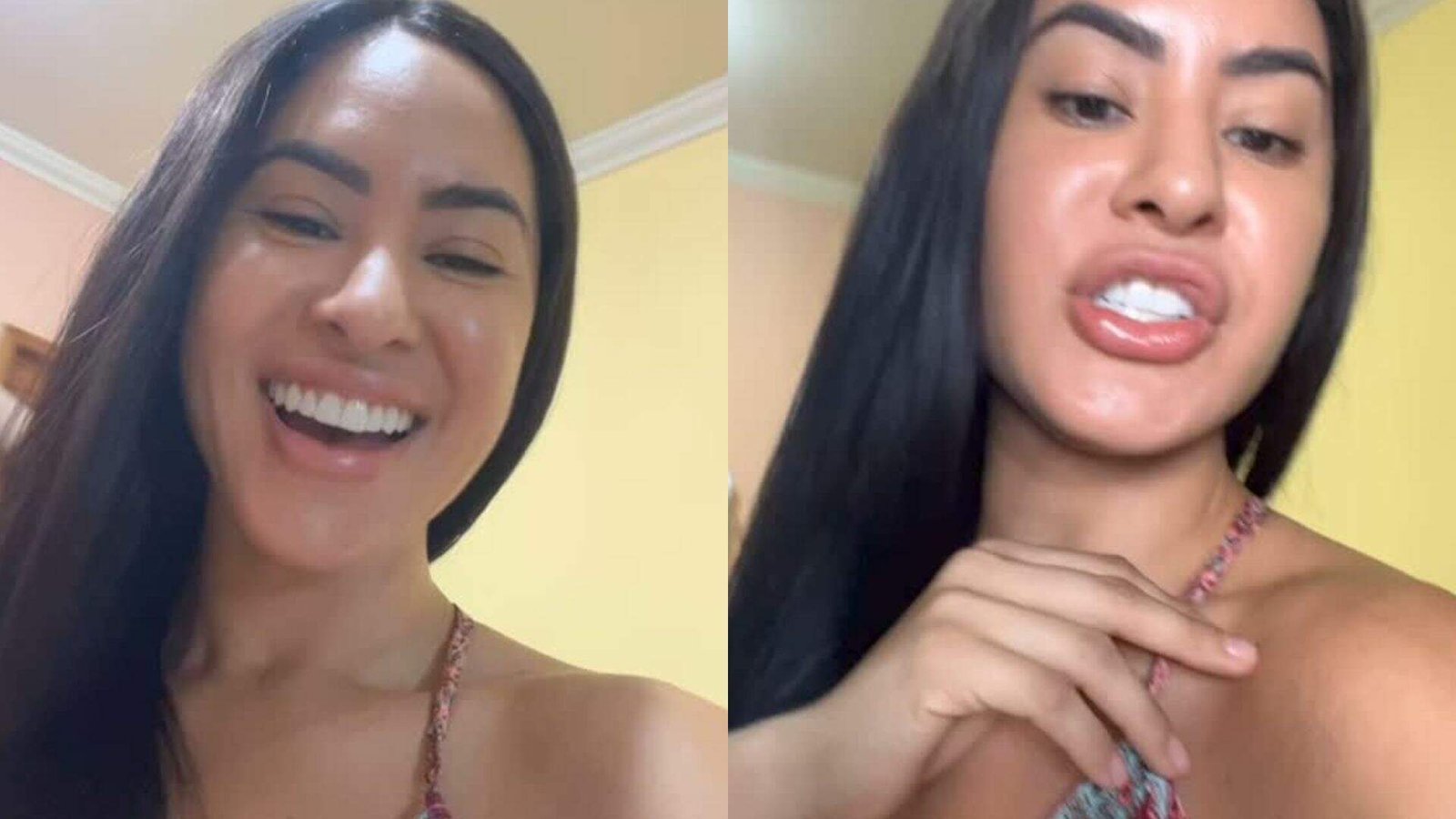 Isabelle volta à rotina após sucesso no Festival de Parintins; ex-BBB exibe hematomas