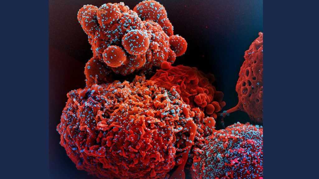 Vírus da COVID estimula a produção de proteínas sem função protetora para subverter a resposta imune
