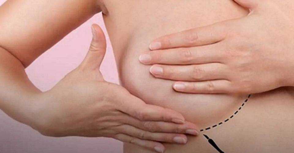 Hospital Aristides Maltez promove curso para detecção precoce do câncer de mama