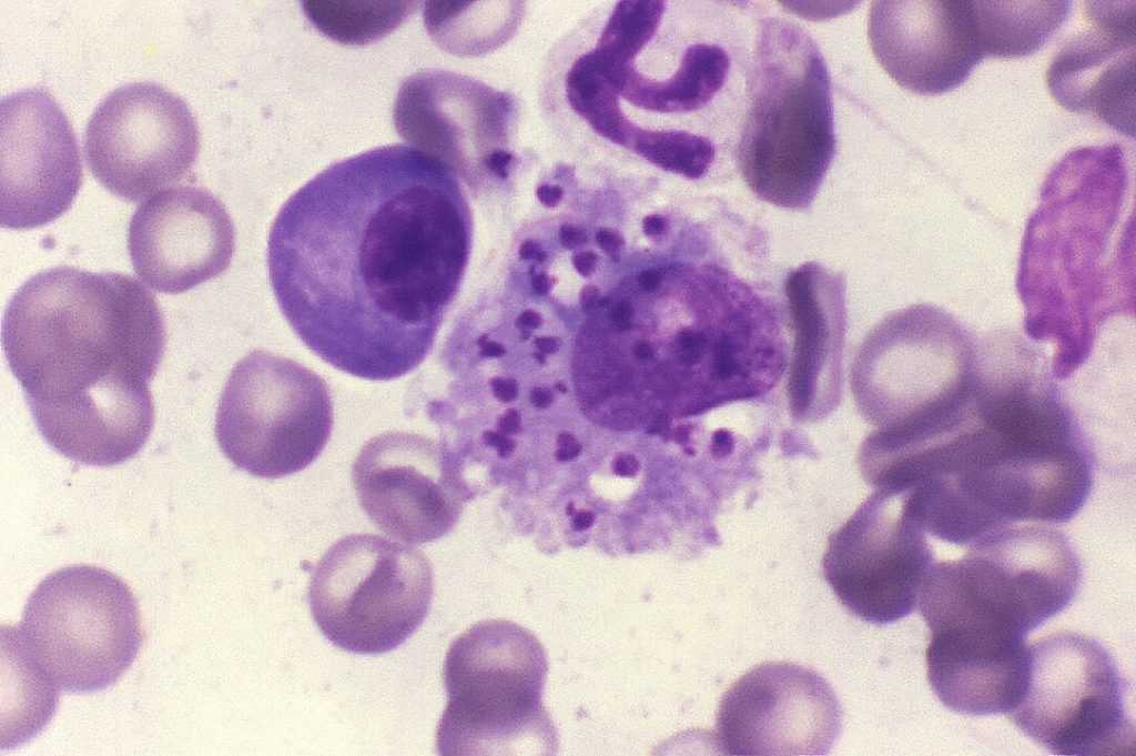Identificação de possíveis alvos para o tratamento da leishmaniose visceral: Estudo revela descobertas promissoras