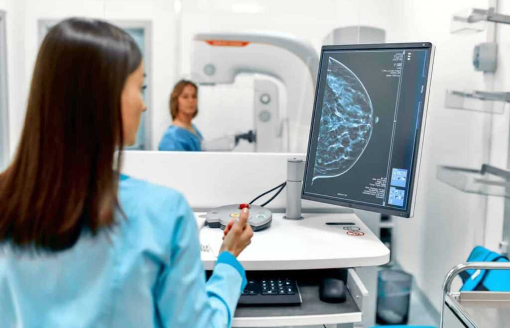 IA aumenta chances de detecção de câncer de mama em 20%