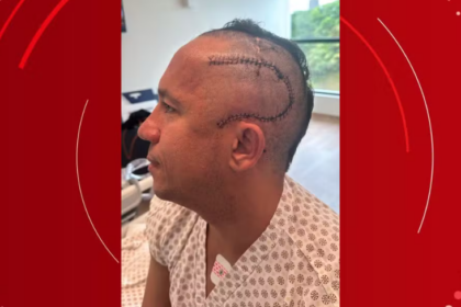 Empresário canta hino do Bahia durante cirurgia para retirar tumor cerebral