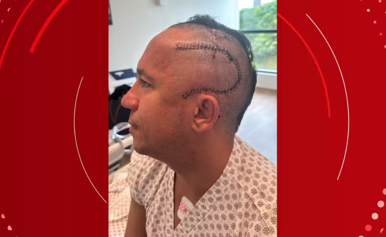 Empresário canta hino do Bahia durante cirurgia para retirar tumor cerebral