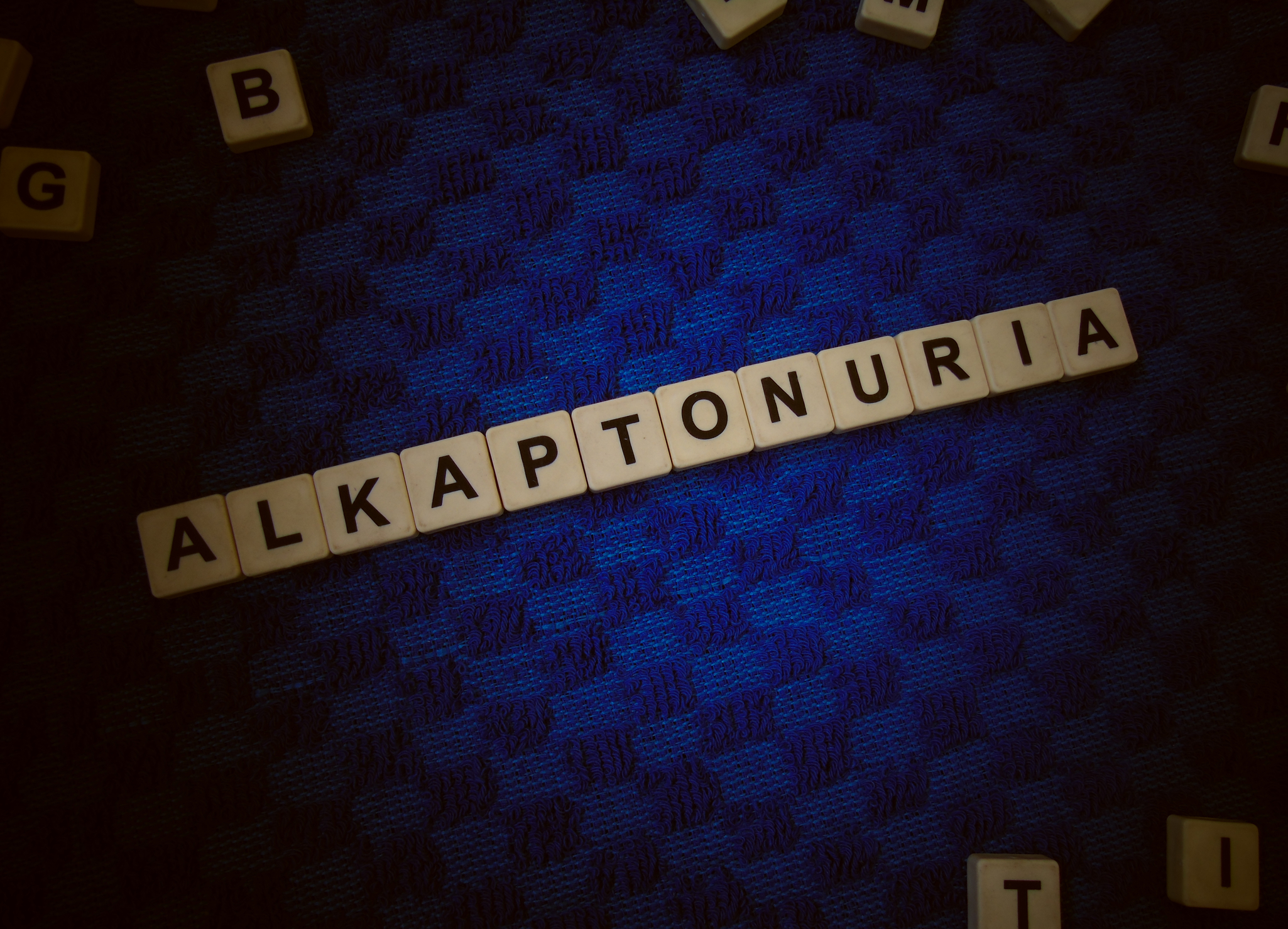 Doença considerada rara pode deixar sua urina preta