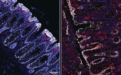 Estudo Revela que Consumo de Fibras Protege o Intestino de Infecções Bacterianas Graves