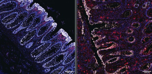 Estudo Revela que Consumo de Fibras Protege o Intestino de Infecções Bacterianas Graves