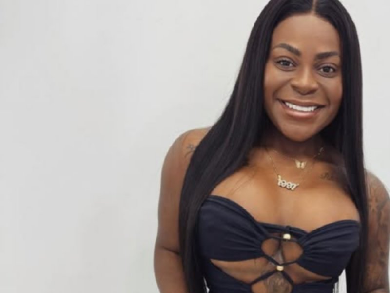 Lipoaspiração de Jojo Todynho: Resultados que surpreenderam!