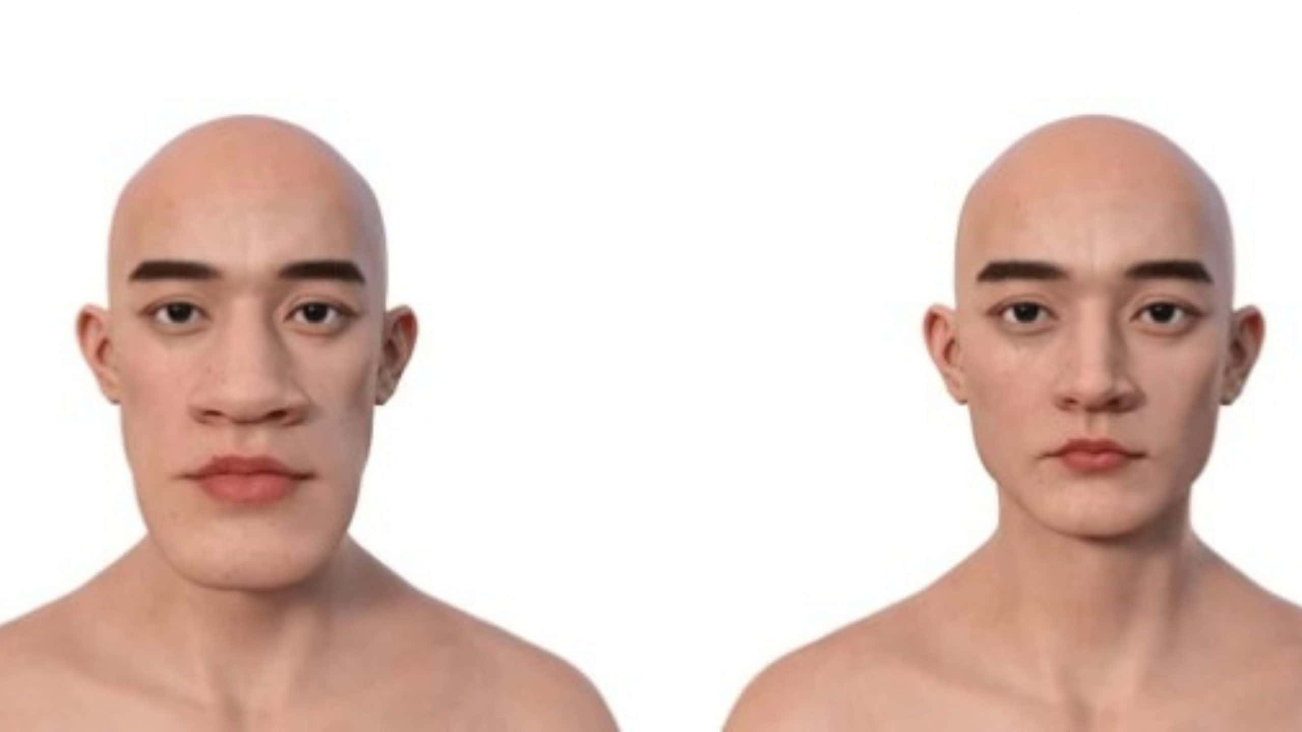 Acromegalia ou gigantismo? Conheça as doenças que fazem o corpo crescer além do limite