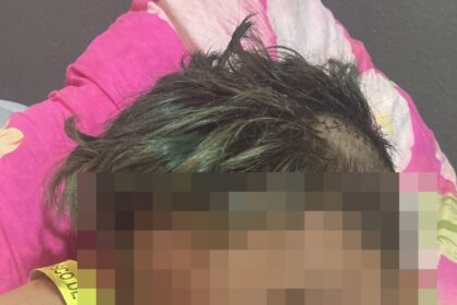 Mãe busca neurocirurgião para filho de 6 anos