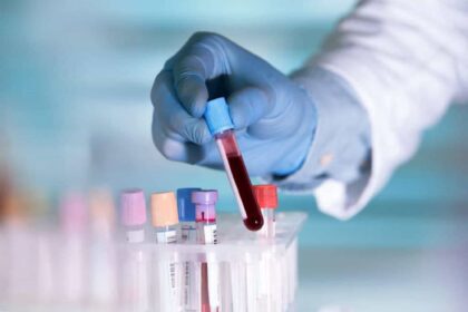Exame de sangue pode detectar Parkinson com antecedência