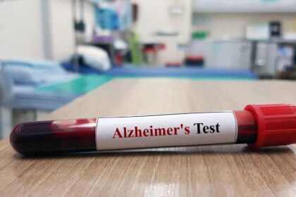 Novo exame de sangue pode melhorar tratamentos do Alzheimer