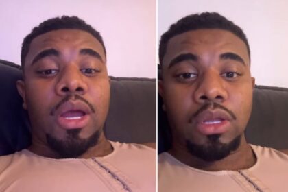 Harmonização Facial: Davi Brito Revela Transformação Surpreendente!