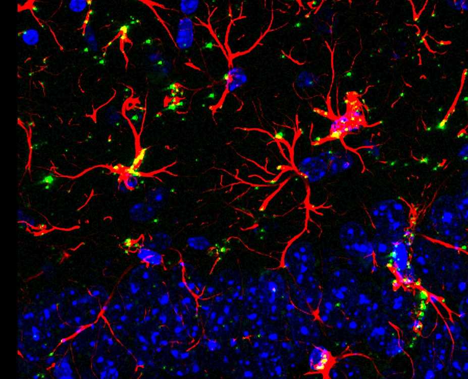 Molécula Inovadora Reverte Déficit Cognitivo Relacionado ao Envelhecimento e Demência em Estudos com Animais