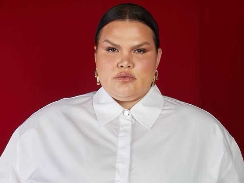 Bariátrica Transformadora: Thais Carla Revela Novo Brilho!