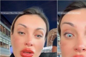 Andressa Urach Arrependida: Mudança nos Olhos e Pedido de Oração
