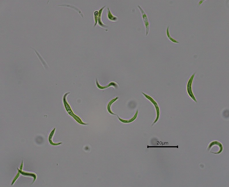 Microalga Eficaz na Remoção de Antibióticos da Água, Reduzindo a Contaminação Ambiental