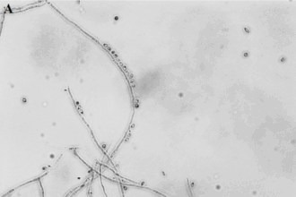 Centro Inovador para Pesquisa de Micoses Endêmicas na América Latina