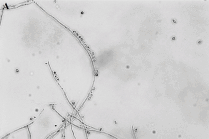 Centro Inovador para Pesquisa de Micoses Endêmicas na América Latina