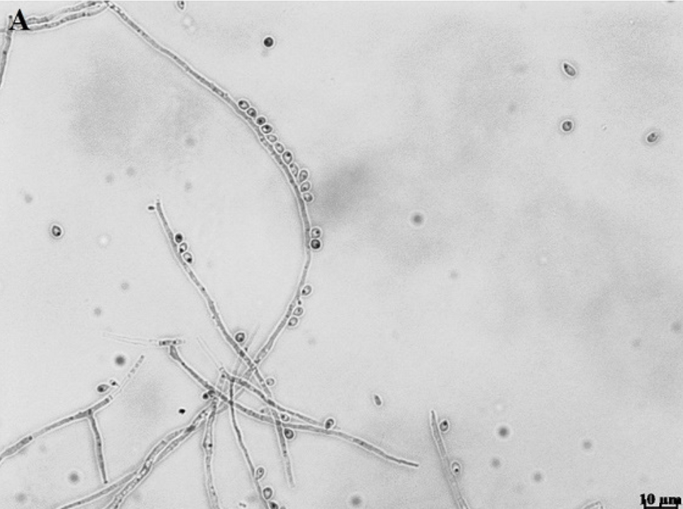 Centro Inovador para Pesquisa de Micoses Endêmicas na América Latina