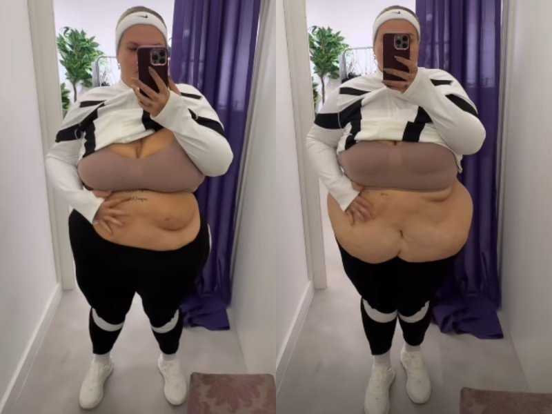 Thais Carla: Transformação Impressionante e Pele Excedente Revelada