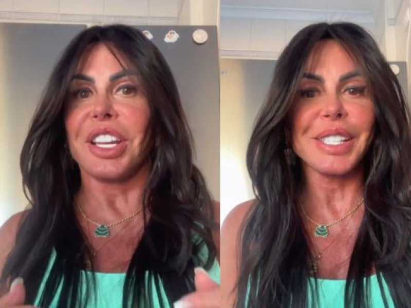 Gretchen Renova o Rosto: Descubra o Segredo da Harmonização!