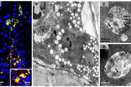 SARS-CoV-2: Como o Vírus Infecciona Células Testiculares e Utiliza Seus Recursos para Se Multiplicar