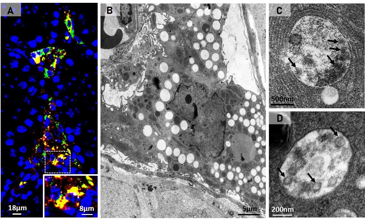 SARS-CoV-2: Como o Vírus Infecciona Células Testiculares e Utiliza Seus Recursos para Se Multiplicar