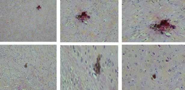 Resultados Promissores de Vacina Contra o Vírus Zika em Testes com Camundongos