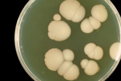 Terapia a Laser: Avanços no Tratamento de Fungos Resistentes a Medicamentos Convencionais