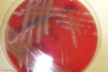 Análise do Mecanismo de Resistência da Bactéria Causadora de Pneumonia e Meningite
