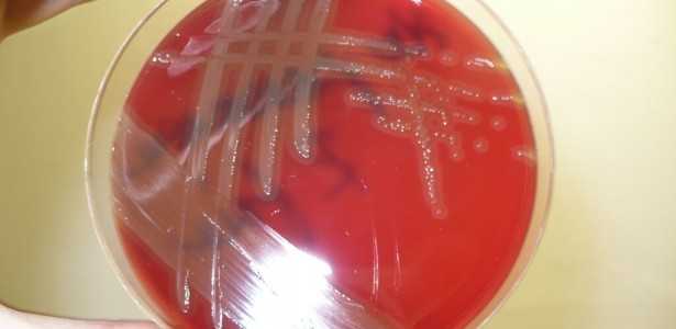 Análise do Mecanismo de Resistência da Bactéria Causadora de Pneumonia e Meningite
