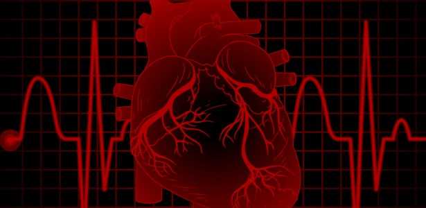 Como as Variações de Glicose Podem Indicar a Gravidade do Dano Pós-Infarto